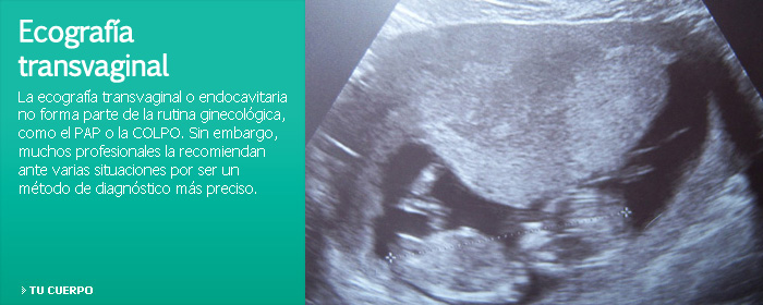 Quistes de ovario: ¿Qué son y cómo se tratan?
